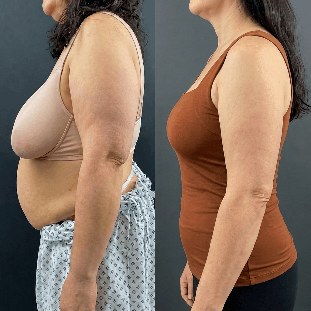 Before and after